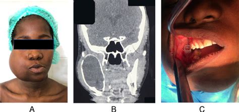 Humanitarian Maxillofacial Mission's Success Requires .